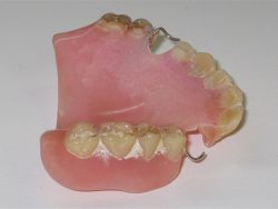 Denture Cleaning: Before