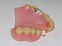 Denture Cleaning: After