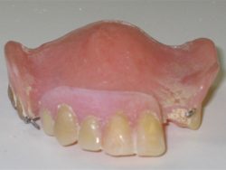 Denture Cleaning: Before