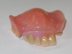 Denture Cleaning: After