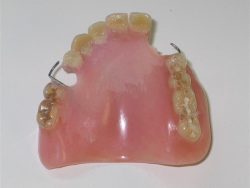 Denture Cleaning: Before